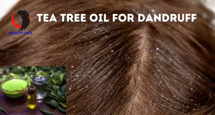 Tea tree oil for dandruff