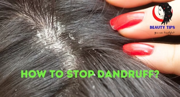 How to Stop Dandruff