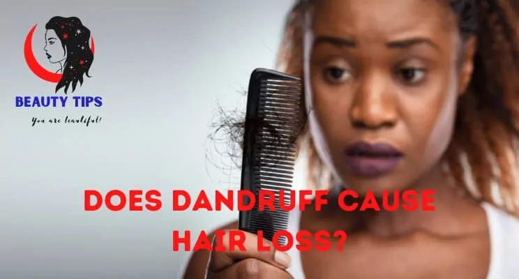 Does Dandruff Cause Hair Loss